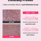 The AHA BHA PHA LHA 35 Peel