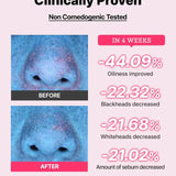 The AHA BHA PHA LHA 35 Peel