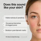A-Control 10% Azelaic Acid Serum