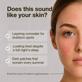 B-Boost 1% Kojic Acid Serum