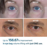 Eyephalt Eyebag Cream