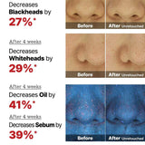 The AHA 2 BHA 2 Blemish Treatment Serum