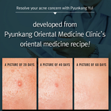 Acne Spot Cream